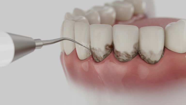 Reliable Wisdom Tooth Removal contractor in Tuscaloosa County County, AL by Dentist Open Now